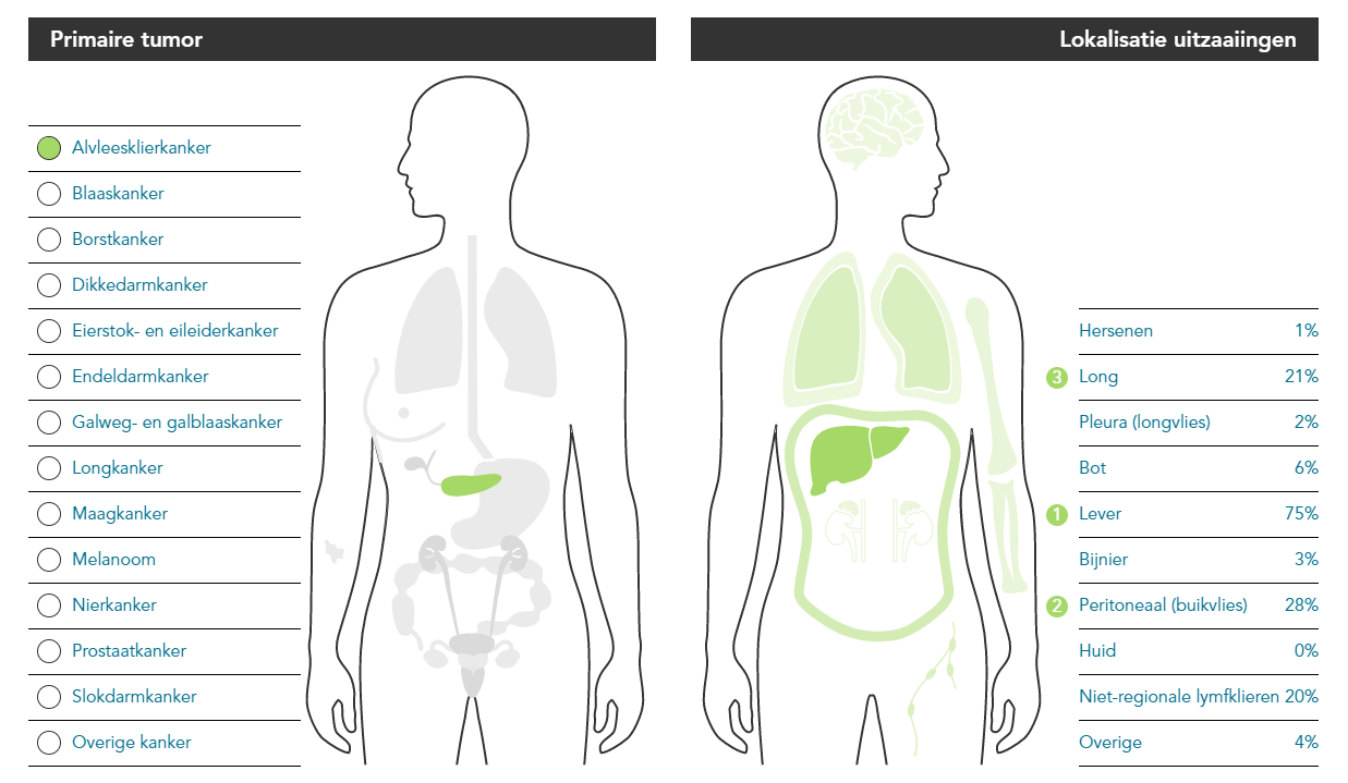 Symposium over uitgezaaide kanker terugkijken