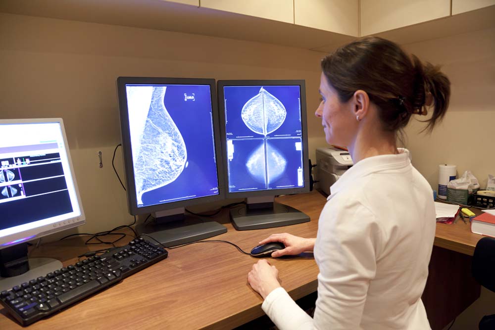 Waarde van fotobespreking voor detecteren additionele borstkanker beperkt