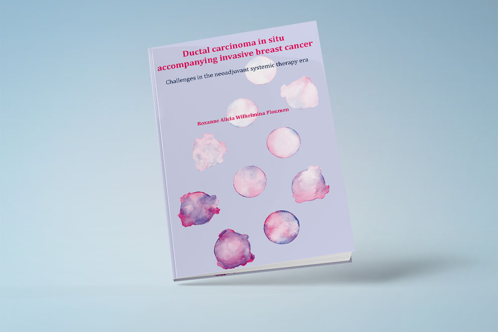 onderzoek naar behandeling invasieve borstkanker met DCIS component Proefschrift Roxanne Ploumen behandeling invasieve borstkanker DCIS component