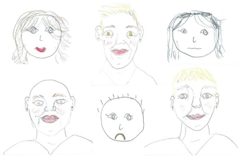 Tekeningen geven inzicht in emotionele impact van haarverlies Tekeningen geven inzicht in emotionele impact van haarverlies