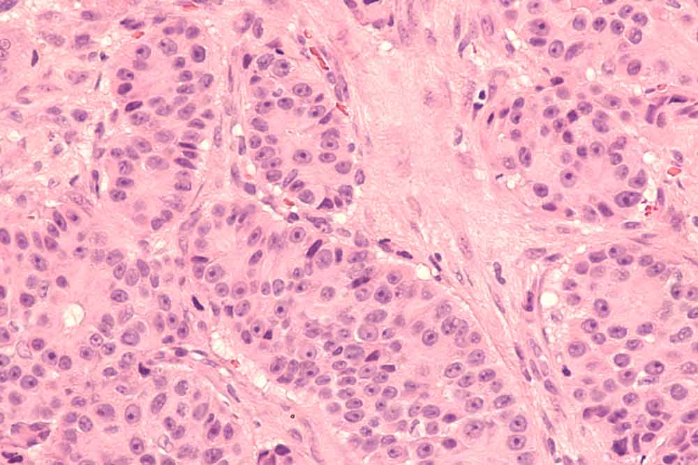 biopt prostaat biopt prostaat